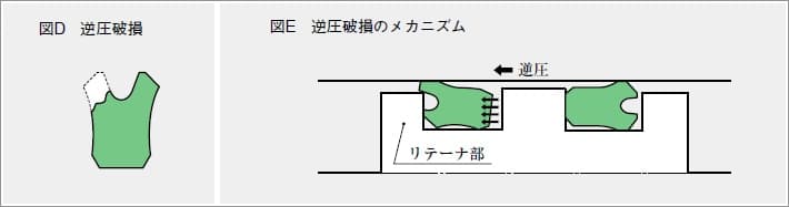 逆圧破損・逆圧破損のメカニズム